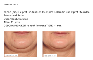 Skin-Effect-Vorher-Nachher